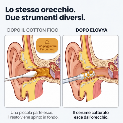 Elovya® Nettoyeur d’oreille adhésif